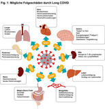 Folgen von Long COVID